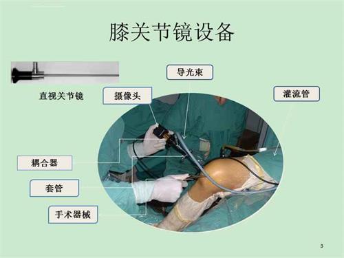 關(guān)節(jié)鏡下無源手術(shù)器械產(chǎn)品注冊(cè)審查指導(dǎo)原則（2021年第102號(hào)）(圖1)