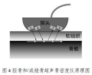 超聲骨密度儀注冊技術(shù)審查指導(dǎo)原則（2017年第180號）(圖4)