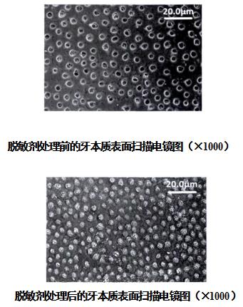 牙科脫敏劑注冊審查指導(dǎo)原則（2021年第102號）(圖2)